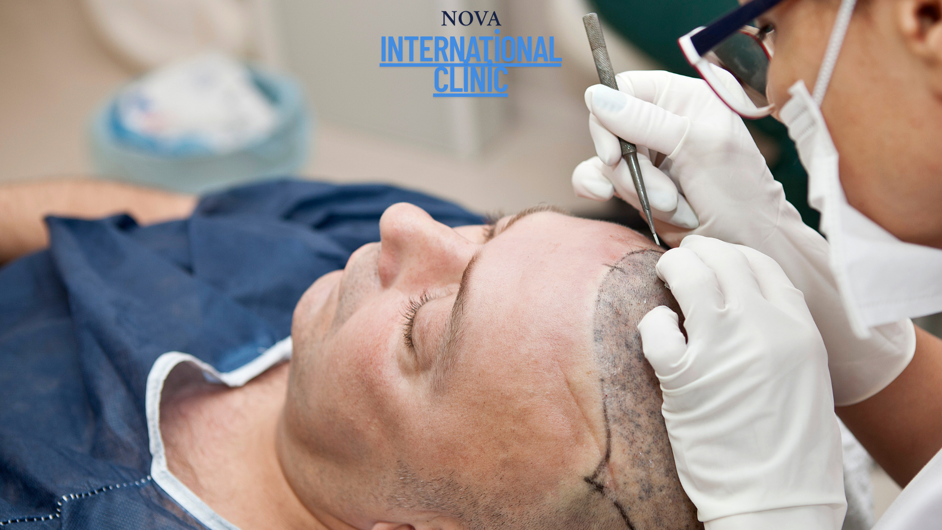 Hair Transplant Specialist